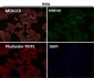 Anti-ALDH2 Monoclonal Antibody